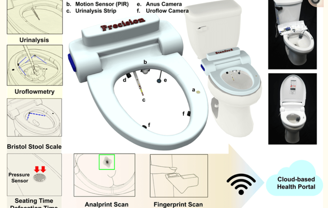 A perspective view of a toilet with a mountable device for continuously measuring baselines of human excreta. The toilet system includes (1) a 10-parameter test-strip-based urinalysis with a retractable cartridge; (2) computer-vision uroflowmetry with two high-speed cameras (the blue dotted lines represent the FOV from each camera); (3) stool classification by deep learning (the blue dotted lines represent the FOV of the defecation monitoring camera); (4) defecation time measurement detected by a pressure sensor below the toilet seat (the red arrow represents the force applied to the pressure sensor); (5) two-biometric identifications, an analprint scan (the green box represents the template-matching algorithm) and a fingerprint scanner on the flush lever; and (6) the ability to transfer all data by wireless communication to a cloud-based health portal system. Right: photographs of the actual system mounted on a toilet.